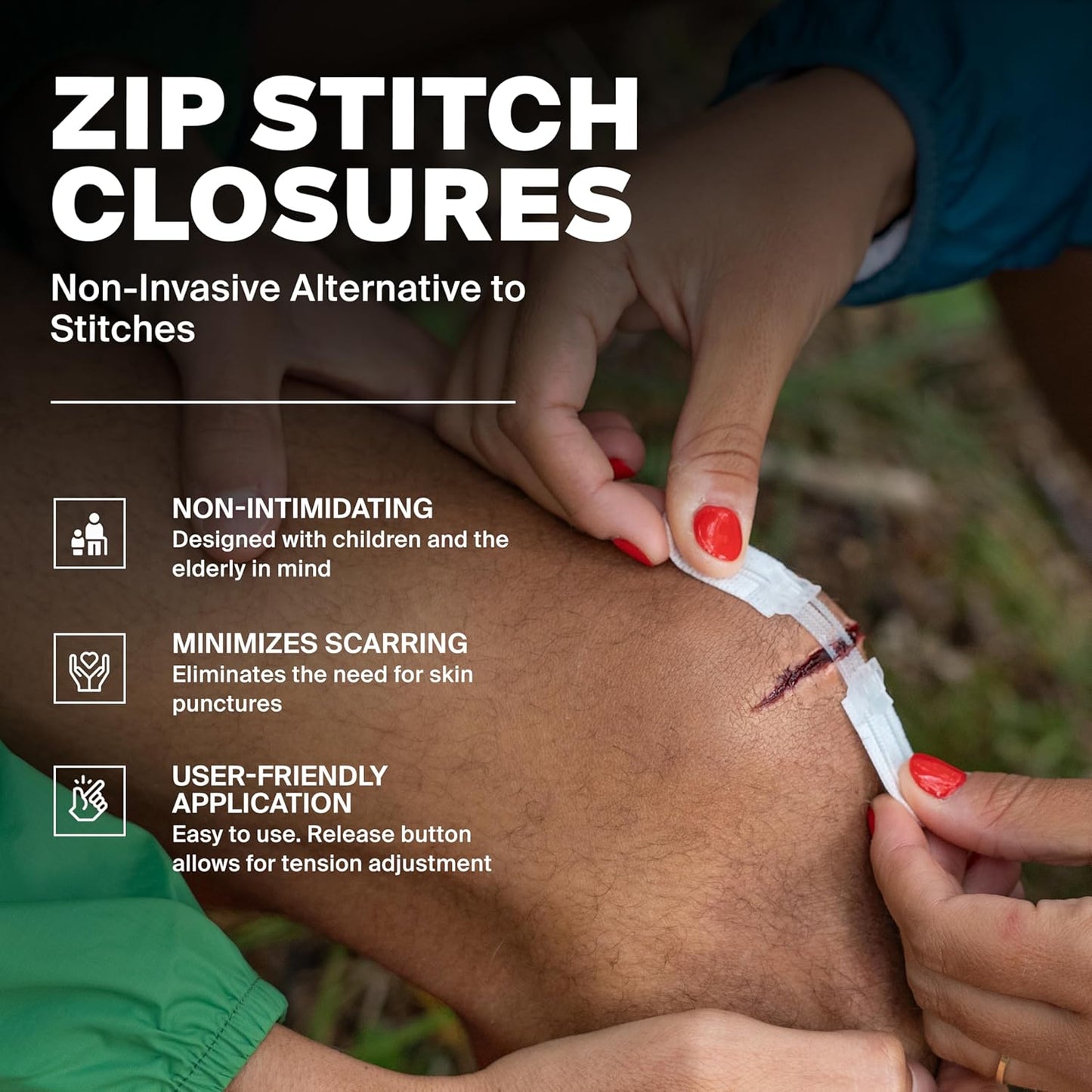 Zip Stitch Wound Closures