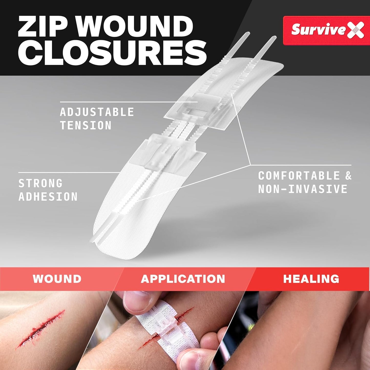 Zip Stitch Wound Closures