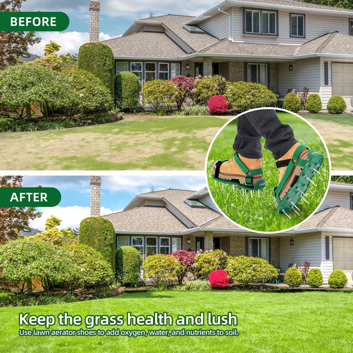 Lawn Aerator Shoes